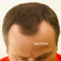 COVER HAIR Haarverdichtung Mit Schütthaar Mittelbraun -Always® shop MAM 5286138 SHOP IMAGE 1.53