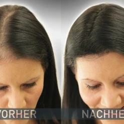 COVER HAIR Haarverdichtung Mit Schütthaar Schwarz -Always® shop MAM 5286506 SHOP IMAGE 1.4